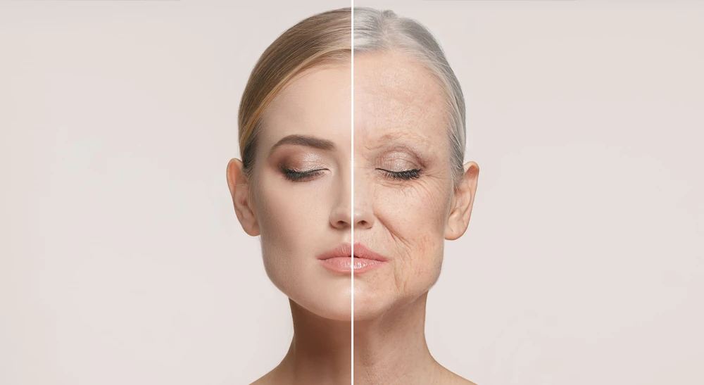 تزریق فیلر Fillers