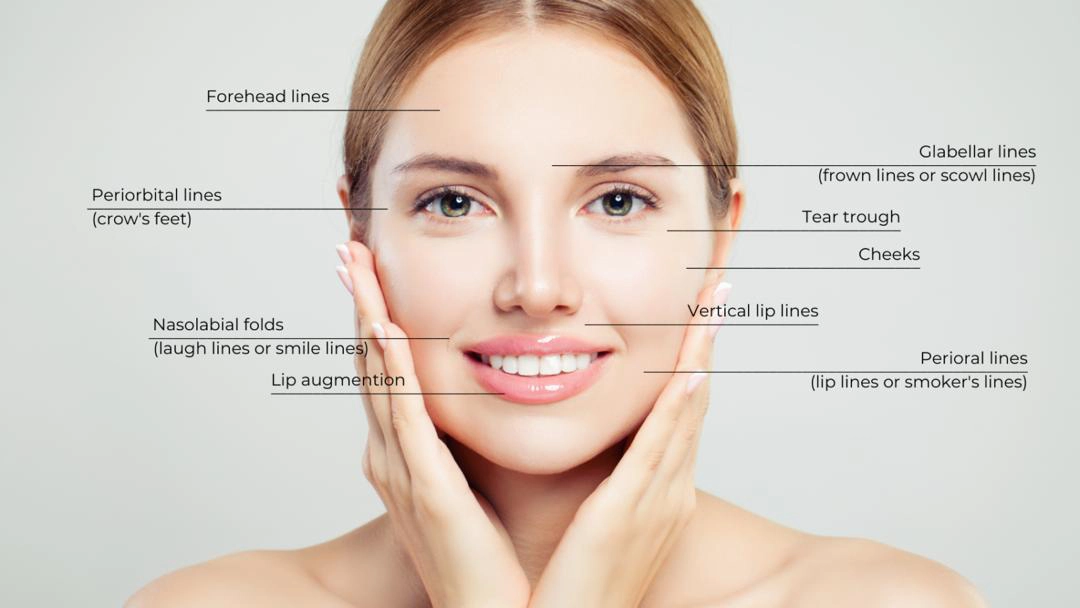 تزریق فیلر Fillers